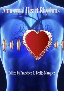 "Abnormal Heart Rhythms" ed. by Francisco R. Breijo-Marquez