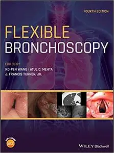 Flexible Bronchoscopy Ed 4