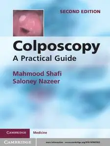 Colposcopy: A Practical Guide