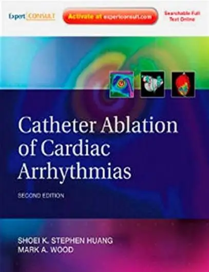 Catheter Ablation of Cardiac Arrhythmias