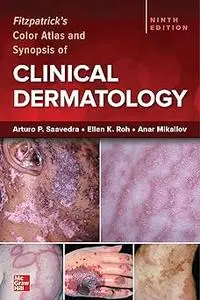 Fitzpatrick's Color Atlas and Synopsis of Clinical Dermatology, Ninth Edition Ed 9