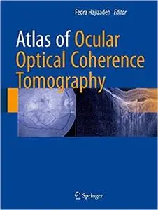 Atlas of Ocular Optical Coherence Tomography (Repost)