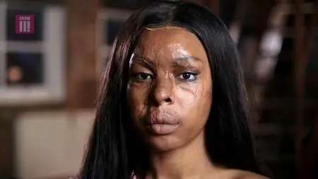 BBC - Acid Attack: My Story (2018)