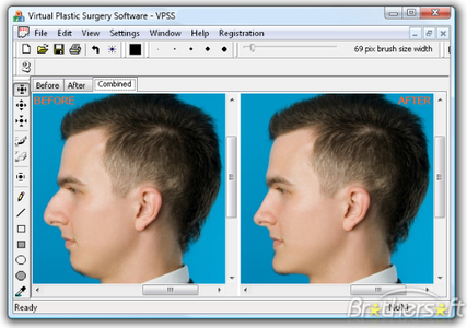 Virtual Plastic Surgery Software 1.2 