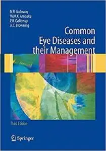 Common Eye Diseases and their Management (Common Eye Diseases and Their Management (Galloway))