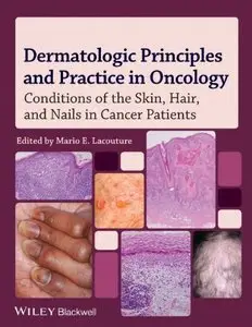 Dermatologic Principles and Practice in Oncology: Conditions of the Skin, Hair, and Nails in Cancer Patients (repost)