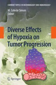 Diverse Effects of Hypoxia on Tumor Progression