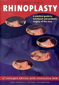 Rhinoplasty: A practical guide to functional and aesthetic surgery of the nose