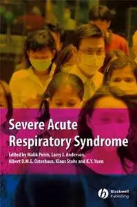 Severe Acute Respiratory Syndrome