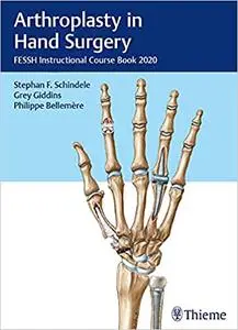 Arthroplasty in Hand Surgery: FESSH Instructional Course Book 2020