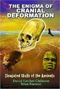 The Enigma of Cranial Deformation: Elongated Skulls of the Ancients