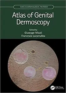 Atlas of Genital Dermoscopy (Series in Dermatological Treatment)