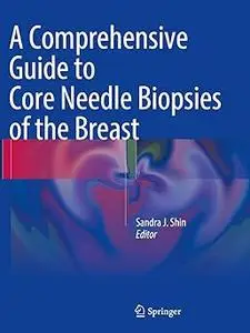 A Comprehensive Guide to Core Needle Biopsies of the Breast (Repost)
