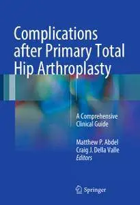 Complications after Primary Total Hip Arthroplasty: A Comprehensive Clinical Guide