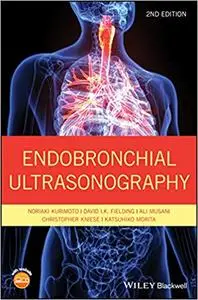Endobronchial Ultrasonography Ed 2