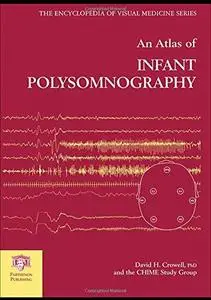 An Atlas of Infant Polysomnography