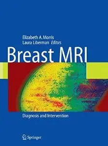 Breast MRI [Repost]
