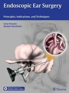 Endoscopic Ear Surgery: Principles, Indications, and Techniques (repost)