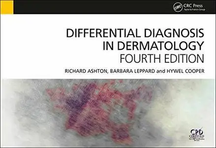 Differential Diagnosis in Dermatology, 4th Edition
