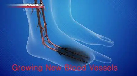 NHK - Medical Frontiers: Growing New Blood Vessels (2018)