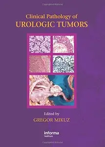 Clinical Pathology of Urological Tumours by Gregor Mikuz