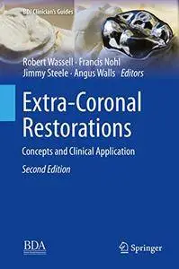 Extra-Coronal Restorations: Concepts and Clinical Application (BDJ Clinician’s Guides) 2nd Edition