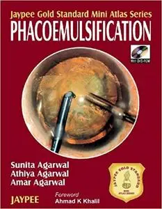 Phacoemulsification