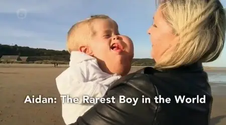 Channel 5 - Aidan: The Rarest Boy In The World (2015)