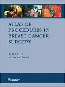 Atlas of Procedures in Breast Cancer Surgery (Repost)