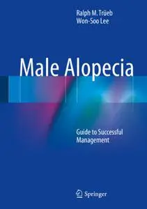 Male Alopecia: Guide to Successful Management (Repost)