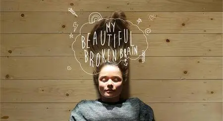 My Beautiful Broken Brain (2014)