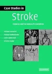 Case Studies in Stroke: Common and Uncommon Presentations (Case Studies in Neurology)