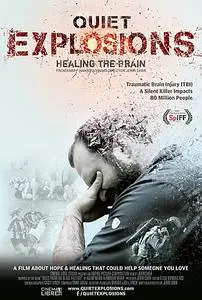 Quiet Explosions: Healing the Brain (2020)