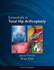 Essentials in Total Hip Arthroplasty (repost)