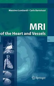 MRI of the Heart and Vessels