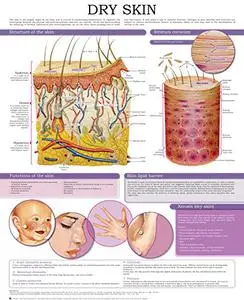 Dry Skine-chart: Quick reference guide