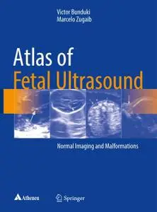 Atlas of Fetal Ultrasound: Normal Imaging and Malformations (Repost)