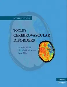 Toole's Cerebrovascular Disorders (6th edition) (repost)