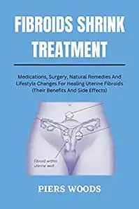 FIBROIDS SHRINK TREATMENT