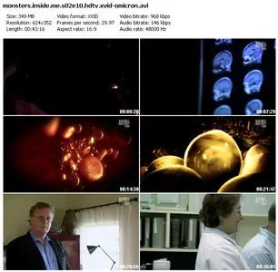Animal Planet - Monsters Inside Me S02E10: Shape Shifters (2010)