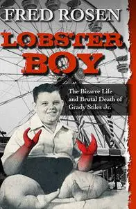 «Lobster Boy» by Fred Rosen