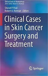 Clinical Cases in Skin Cancer Surgery and Treatment