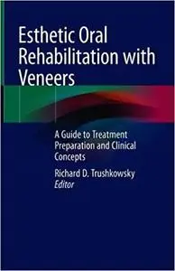 Esthetic Oral Rehabilitation with Veneers: A Guide to Treatment Preparation and Clinical Concepts