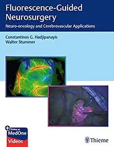 Fluorescence-Guided Neurosurgery: Neuro-oncology and Cerebrovascular Applications