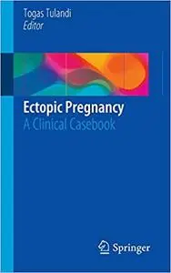 Ectopic Pregnancy: A Clinical Casebook