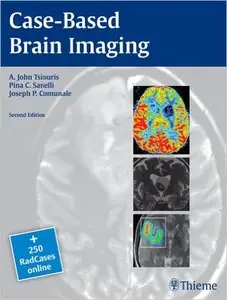 Case-Based Brain Imaging (2nd edition) 