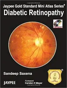 Diabetic Retinopathy