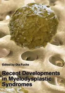 "Recent Developments in Myelodysplastic Syndromes" ed. by Ota Fuchs
