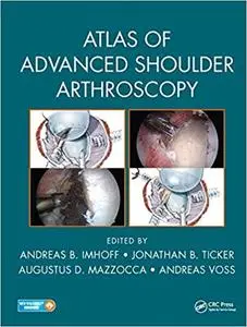 Atlas of Advanced Shoulder Arthroscopy (Repost)