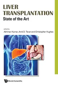 Liver Transplantation: State Of The Art